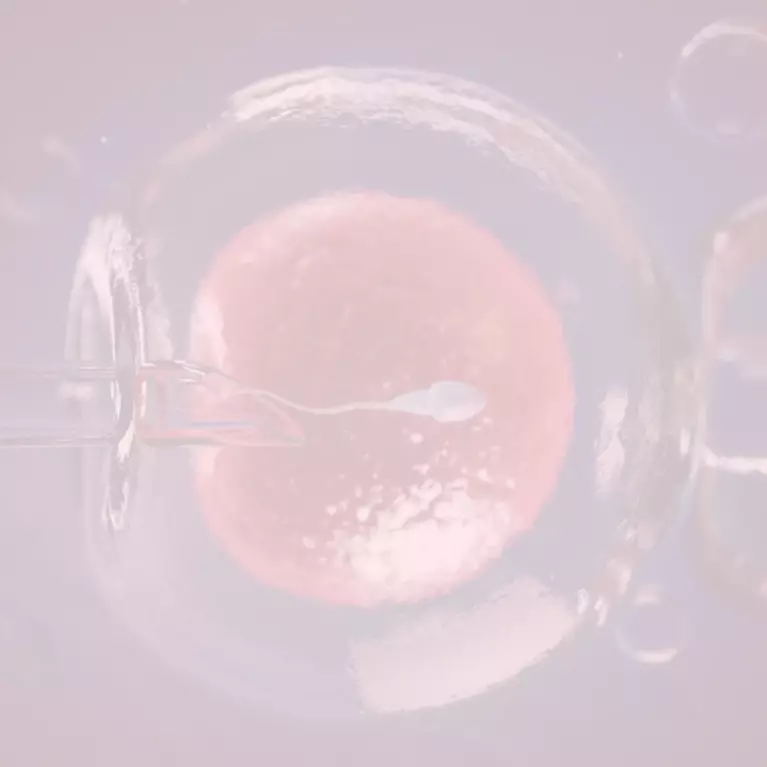 Intracytoplasmic Sperm Injection