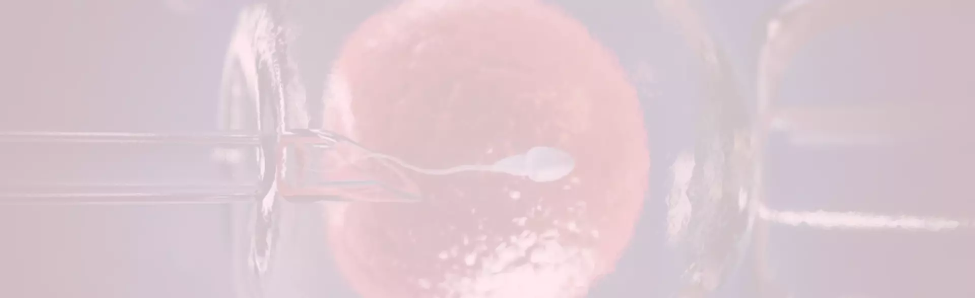 Intracytoplasmic Sperm Injection